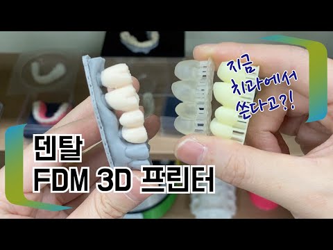 덴탈 FDM 3D 프린터 - 지금 치과에서 사용해요?