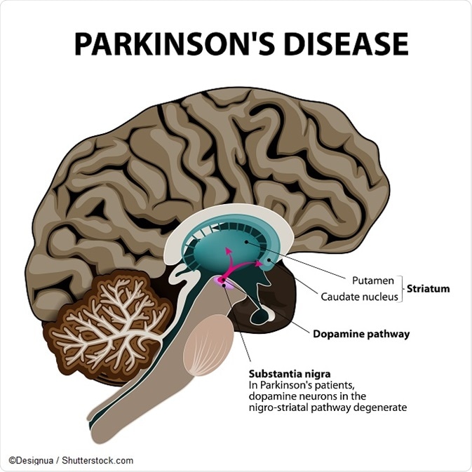 Parkinson'S Disease Pathophysiology
